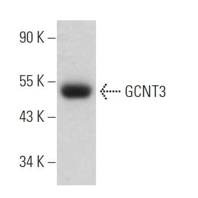 GCNT3抗体 D 7 SCBT Santa Cruz Biotechnology