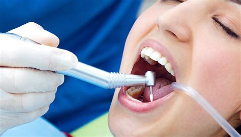 What Is Deep Teeth Cleaning Dr Parul Mehta Associates