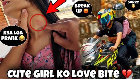 Cute Girl Ne Diya Dhoka Love Bite Prank Gone Wrong Ex Se Gayi