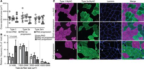 Dysregulated Genes MicroRNAs Biological Pathways And Gastrocnemius