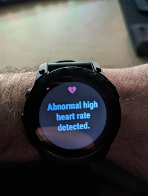 Abnormal Heart Rate Warning During Sex R Garmin