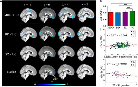 Frontiers Reduced Gray Matter Volume In Orbitofrontal Cortex Across