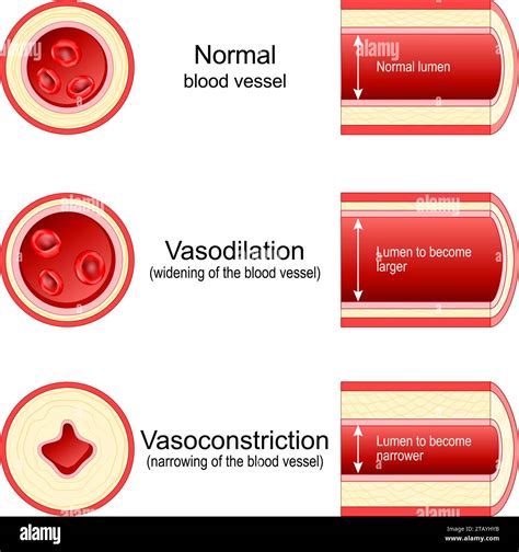 Vasoconstriction and Vasodilation of an artery. Lumen of vein. Cross ...