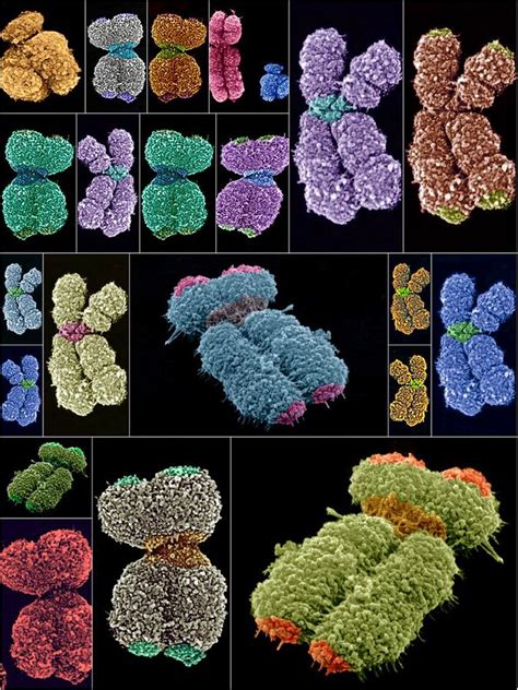 Human Chromosomes Sems Photograph By Science Photo Library