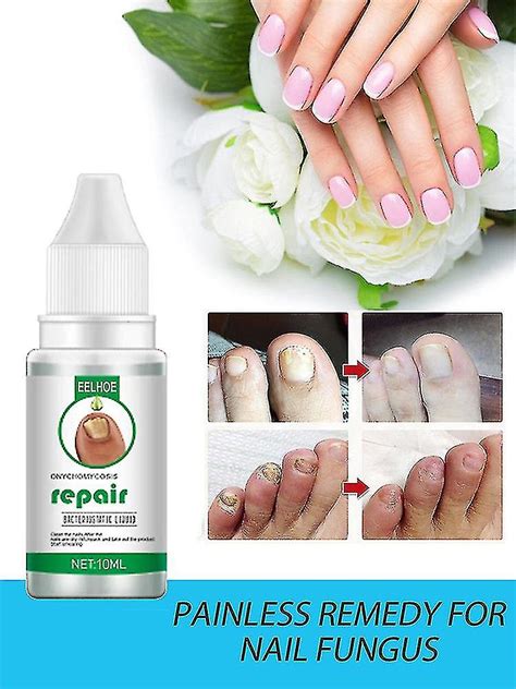 1 Pc Fungal Nail Treatments Finger Toe Nail Repair Serum Onychomycosis