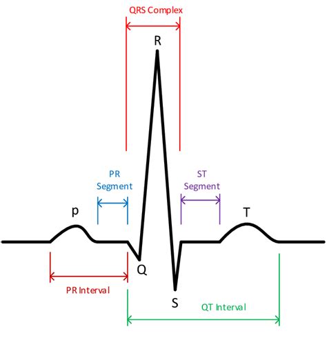 a). The typical ECG-beat | Download Scientific Diagram