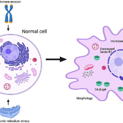 Diabetes And Cellular Senescence Aging And Obesity Induce Inflammation