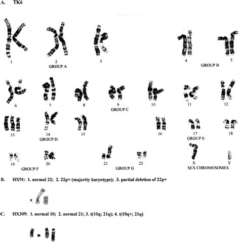 A The Parental Tk6 Karyotype Three Characteristic Abnormalities ϩ