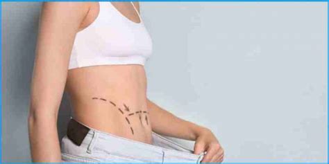 Abdominoplastie En Tunisie La Chirurgie Qui Vous Offre Un Ventre Plat