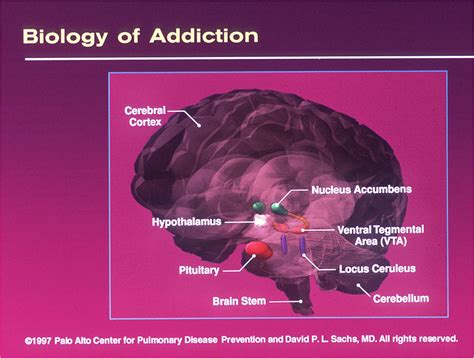 Alternative Health Truth vs Hype: Nutrition and Addiction (Alcohol ...