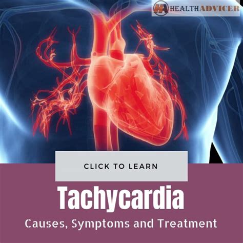 Tachycardia Symptoms Causes And Treatment | Images and Photos finder