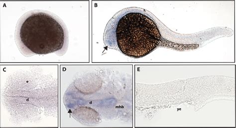 Early Expression Of Ntrk B Is Seen In The Head Using Whole Mount In