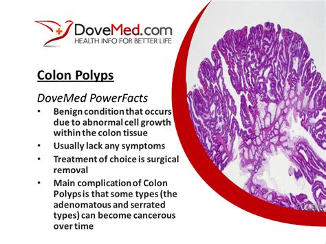 Colon Polyps