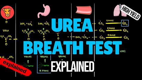 Urea Breath Test For Helicobacter Pylori Explained Youtube