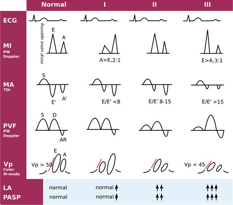 Diastolic Function in 2023 | Cardiac sonography, Diagnostic medical ...