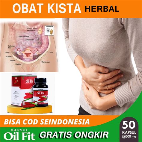 Jual Obat Kista Ovarium Bartholin Rahim Endometriosis Miom Kista Coklat