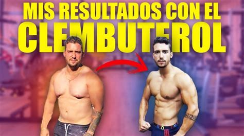 Clembuterol Antes Y Despues Fisiomorfosis