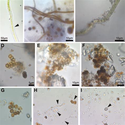 Scanning electron micrographs of characteristic microbial morphologies ... 