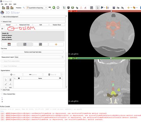 Export Segmentation As Dicom In Latest Stable Slicer Support D