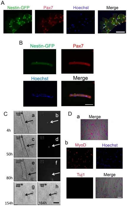 A A Representative EDL Muscle Cross Section From A Nestin GFP