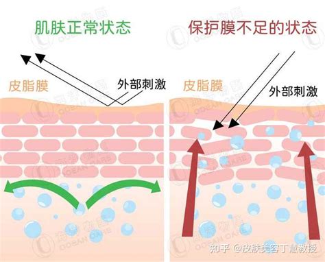 脸部皮肤屏障受损怎么修复？ 知乎