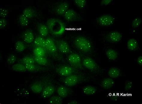 Nuclear Without Mitotic Staining University Of Birmingham