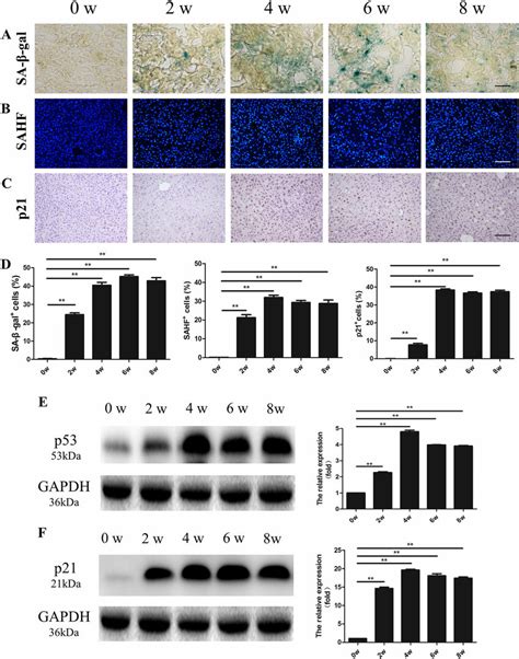 Severe Acute Liver Injury Leads To Hepatocyte Senescence A