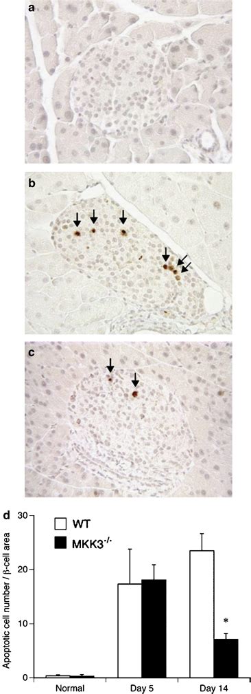 Islet Cell Apoptosis In MLD STZ Immunostaining For Cleaved Caspase 3