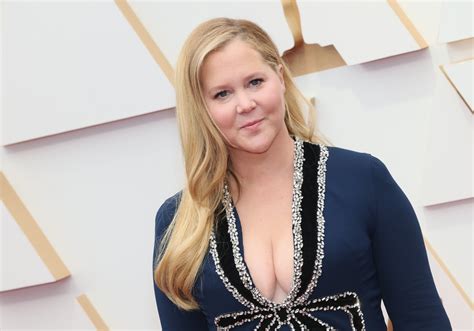 What Is Cushing's Syndrome? Amy Schumer's Condition Explained - Newsweek