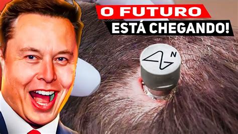 Neuralink De Elon Musk Inicia Testes Em Humanos YouTube