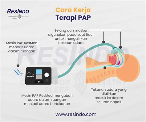 Sleep Apnea Resindo Medika