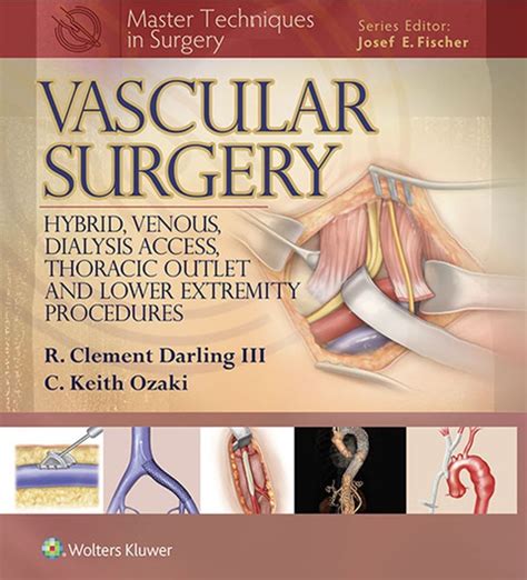 Master Techniques In Surgery Vascular Surgery Hybrid Venous Dialysis