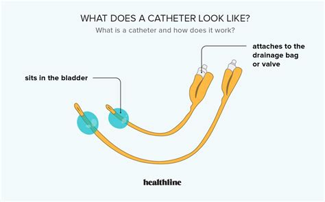 The Diagram Shows What Does A Catheter Look Like And How It Works