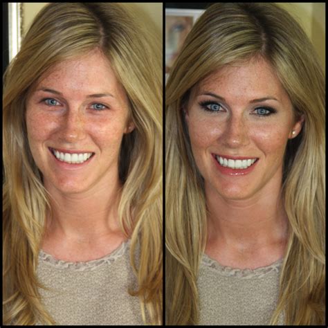 Makeup Before And After A Perfect Example Of Why Not To Cover Up Freckles