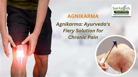 Agnikarma Therapy Ayurveda S Fire Healing