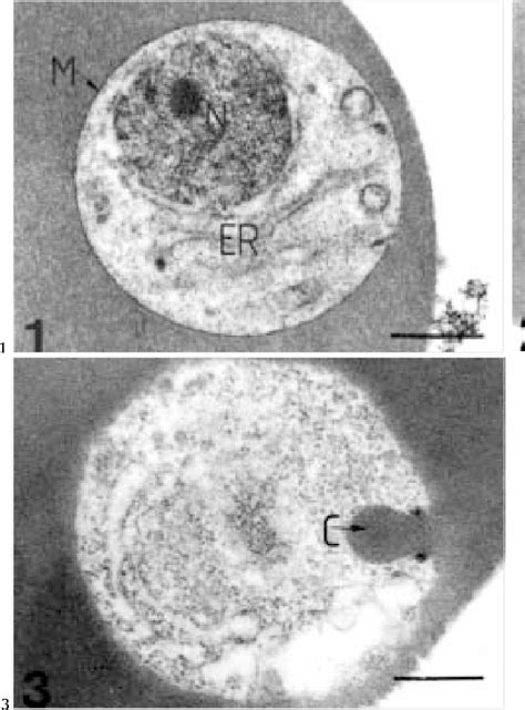 Figure 2 From Ultrastructure Of Babesia Equi Trophozoites Isolated In