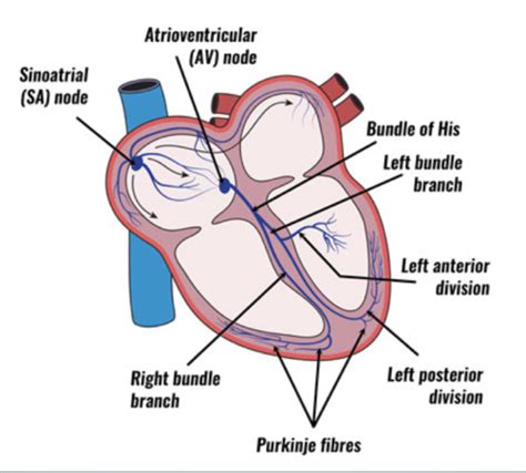 Module 3 Cardio Pathophysiology II Flashcards Quizlet