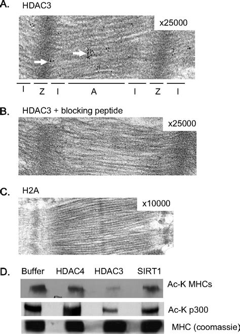 Hdac Dependent Reversible Lysine Acetylation Of Cardiac Myosin Heavy