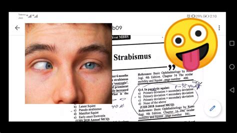 Strabismus Eye Ophthalmology Lectures Mcqs Past Paper Uhs Nums YouTube