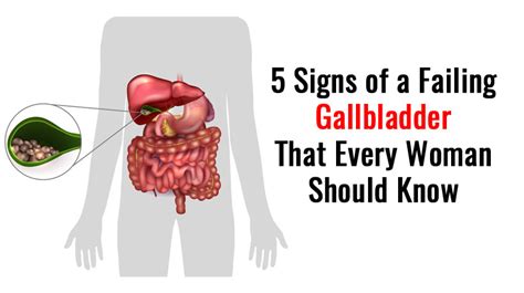 Symptoms Of Gallbladder Issues Verypg