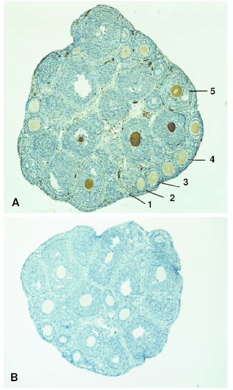 Immunolocalization Of The Ssec P Protein In The Mouse Ovary An Ovarian