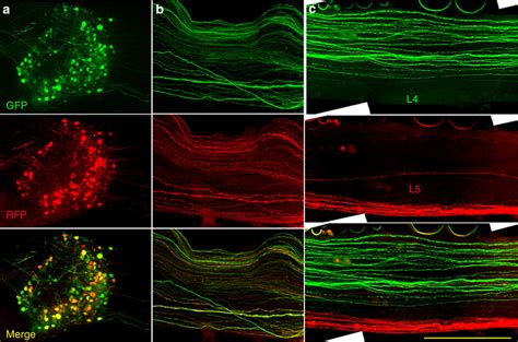 Expression Of Multiple Genes In DRG Neurons A The Representative