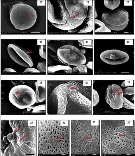 Figure From Morphological Diversity Of Pollen Grains Within The