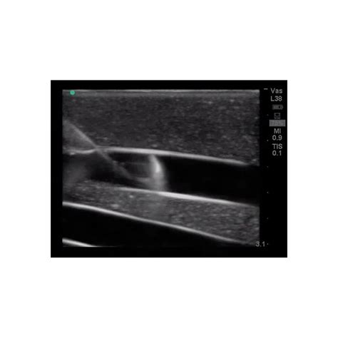 Internal Jugular Central Line Ultrasound Training Model Adam Rouilly