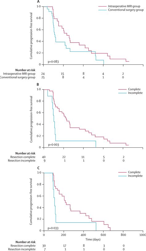 Intraoperative MRI Guidance And Extent Of Resection In Glioma Surgery