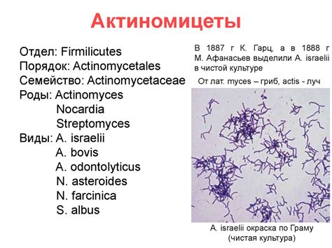 Actinomyces treatment antibiotics