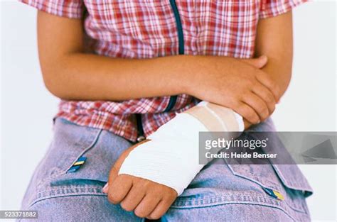 Broken Wrist Cast Photos and Premium High Res Pictures - Getty Images