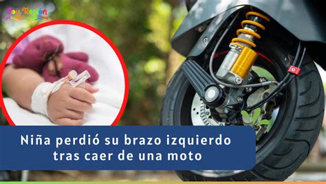 Ni A De A Os Perdi Su Brazo Izquierdo En Tr Gico Accidente En Moto