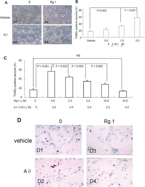 The Effect Of Ginsenoside Rg1 On Aβ 1 42 Induced Neurotoxicity