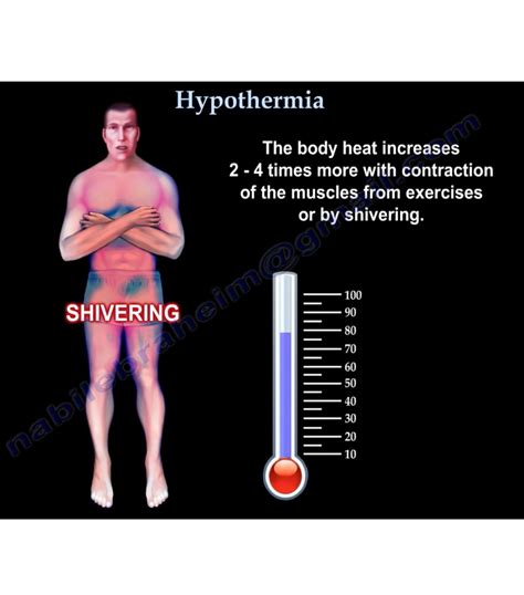 Hypothermia Principles And Management —